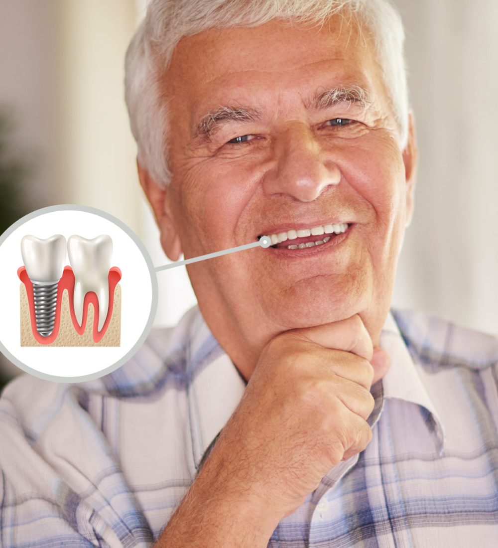 dentista-implante-dentário-em-são-joão-del-rei-mg